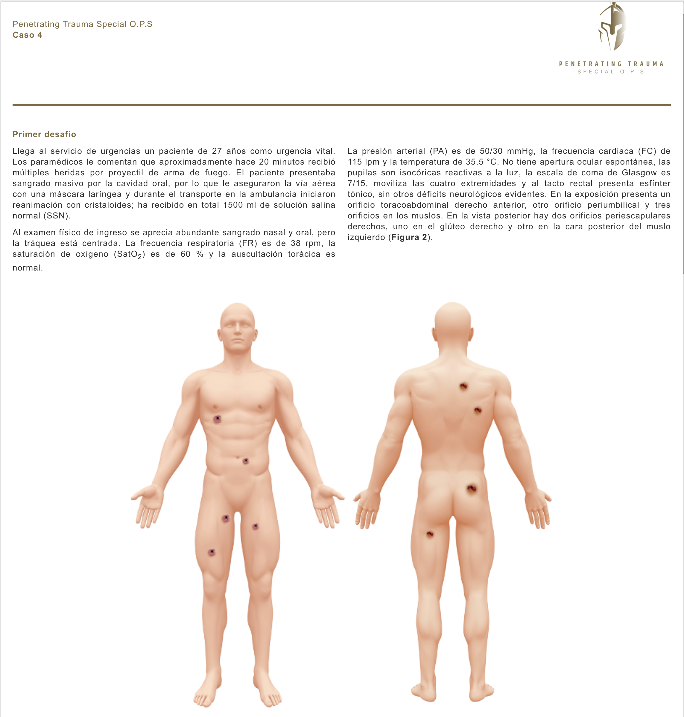 Caso 4 (ES): Heridas por arma de fuego en el torso. No dejarse confundir!
