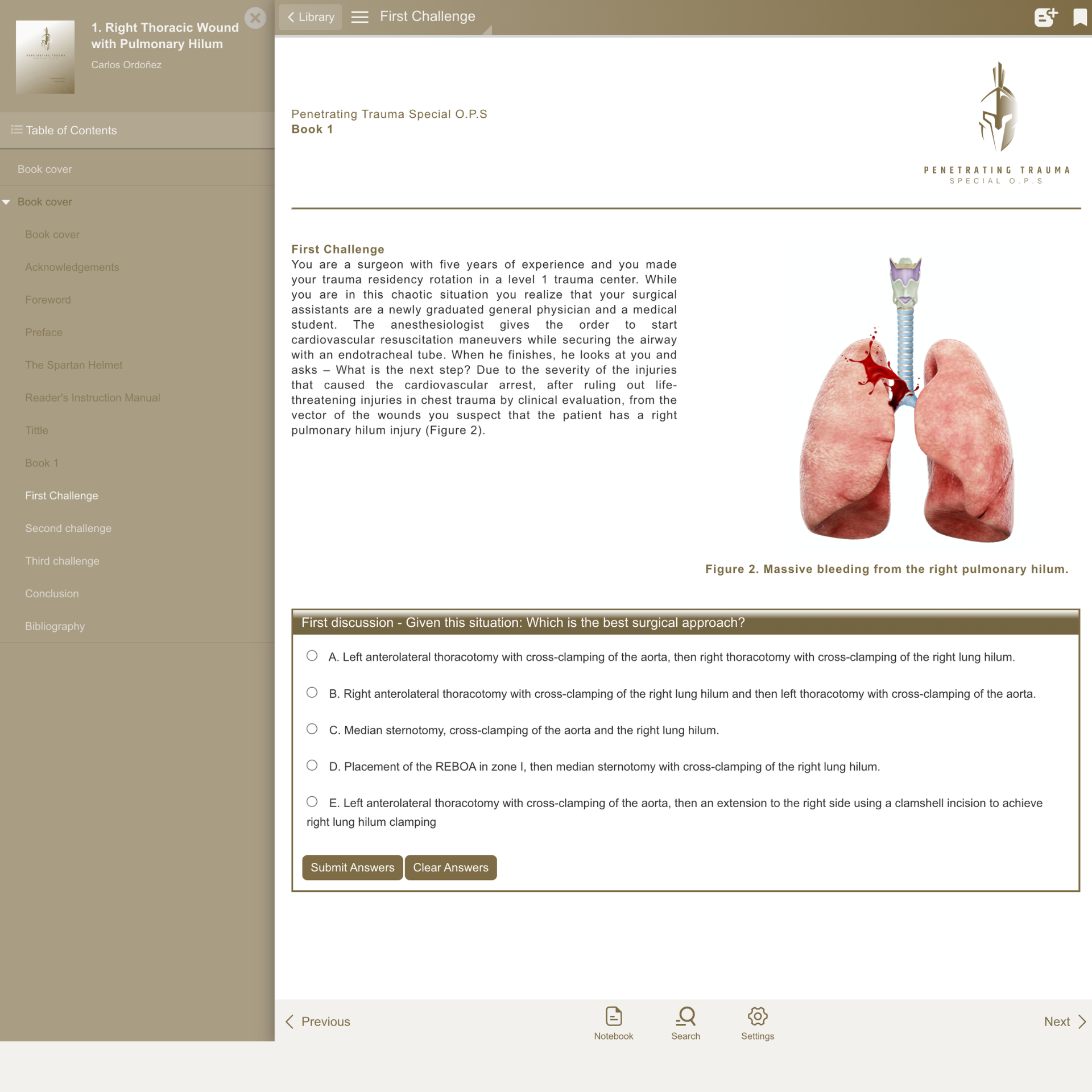 Demo Case (EN)